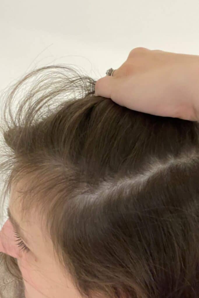 A person with brown hair is pulling back their hair to reveal the scalp and hair roots. The hand appears to have a ring on one finger. The hair is parted to one side, and the background is plain and light-colored.