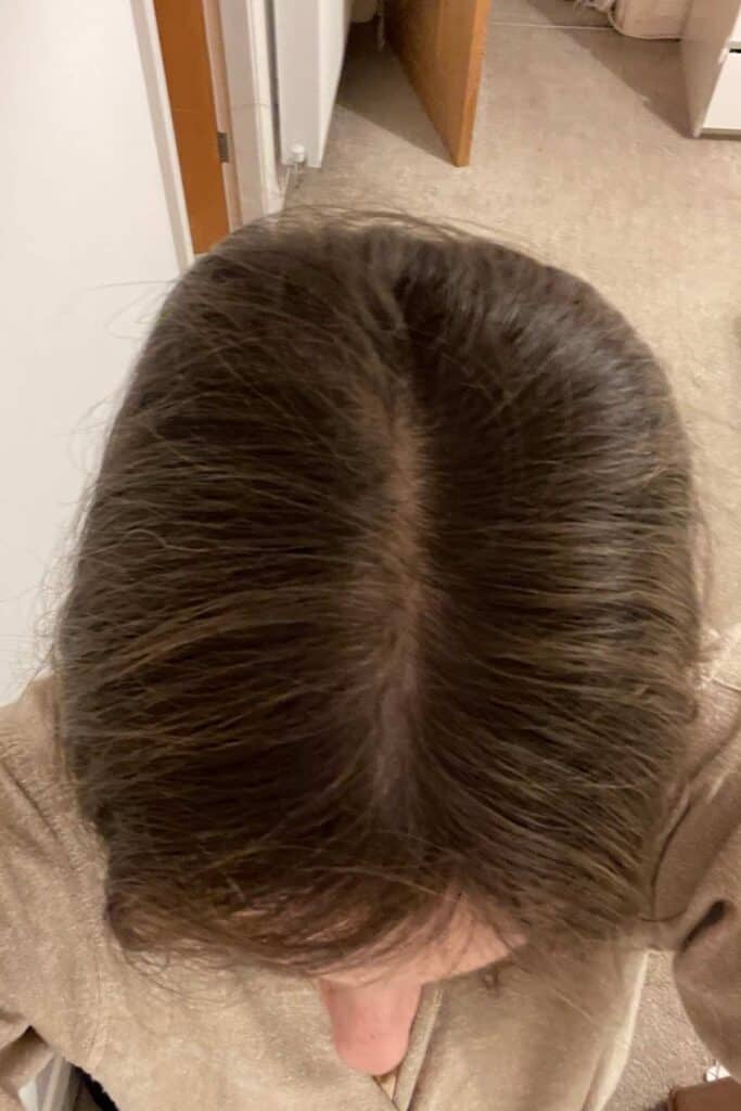 Top view of a person with brown, straight hair showing a patchy center parting. They are wearing a light brown or beige garment. 