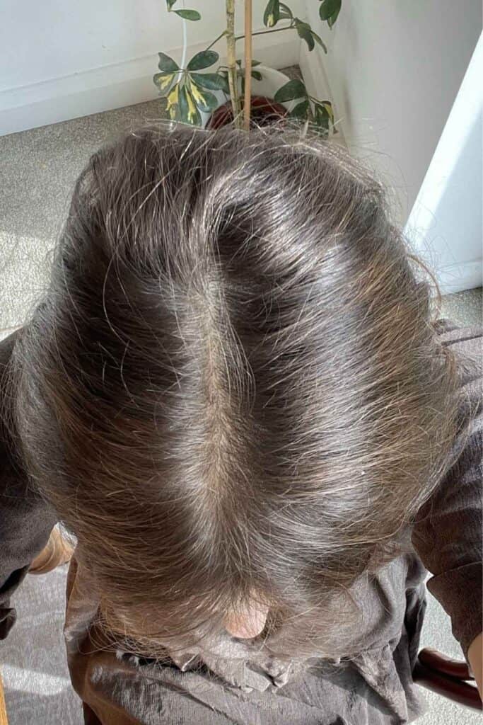 Top view of a person with brown hair, showing the scalp and a central parting. The person is seated on a chair in a room with sunlight coming in. The parting shows an improvement in hair density following the use of Feel Hair Support supplement.